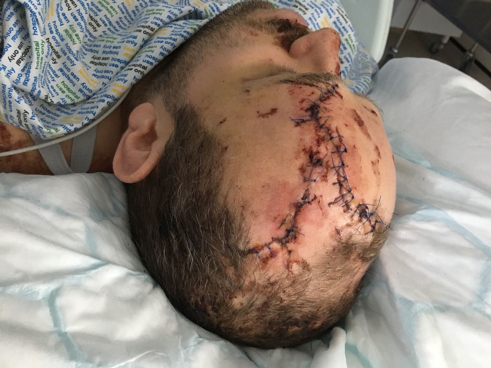 Perry Tatler soldier with PTSD