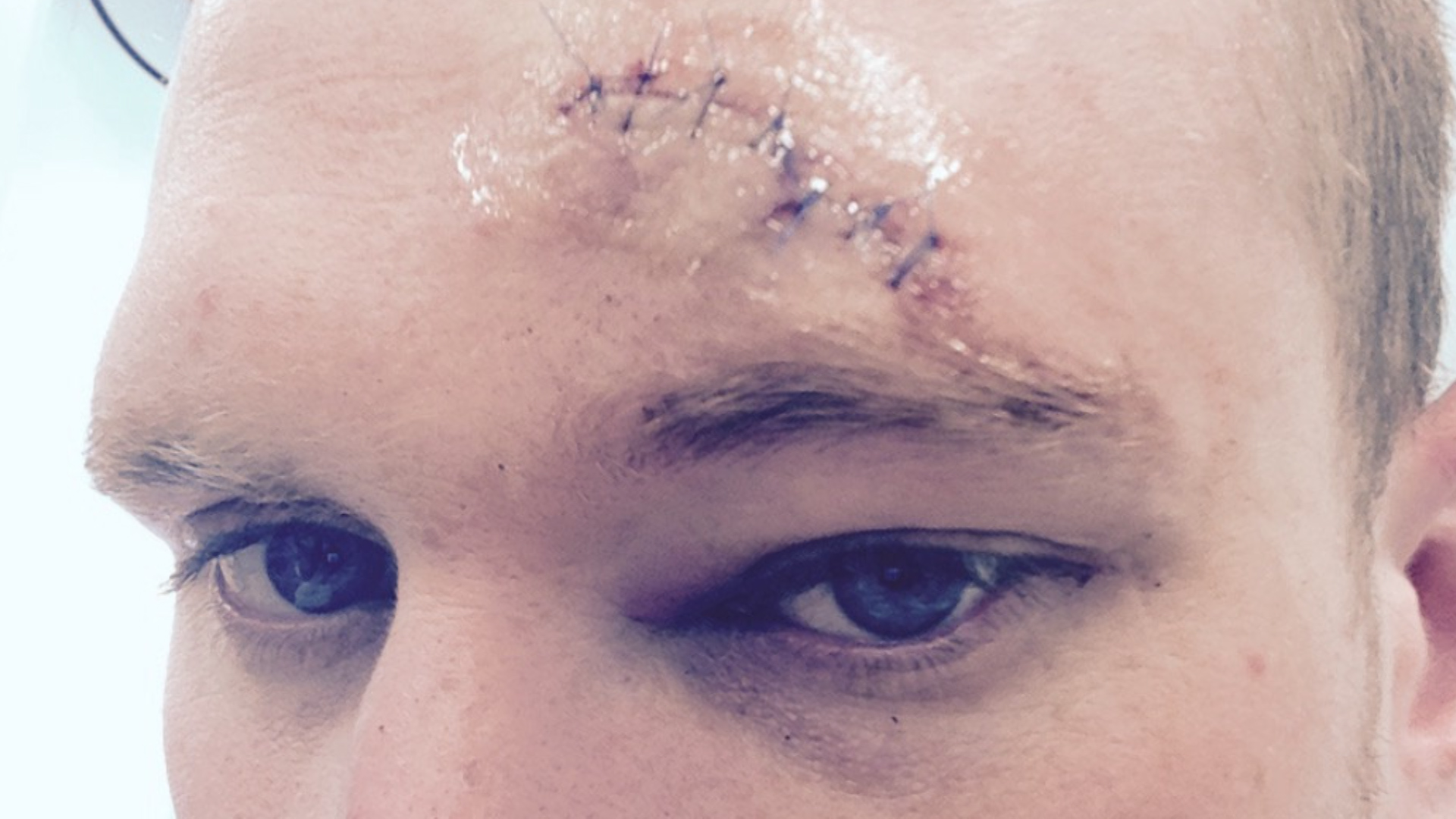 Bubble Football Incident - Matthew Palmer 