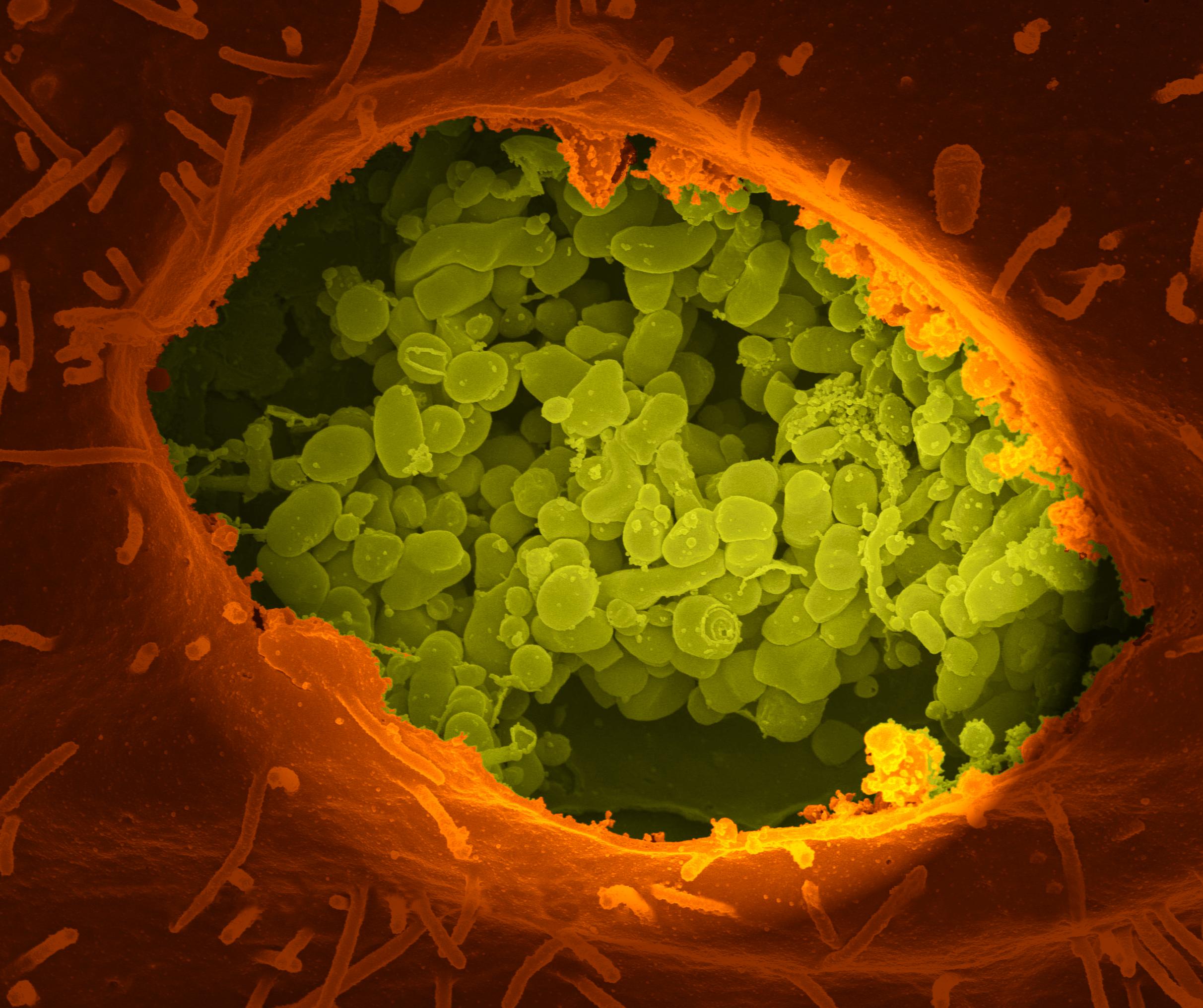Coxiella Burnetii - the bacteria that causes Q fever CREDIT NIAID