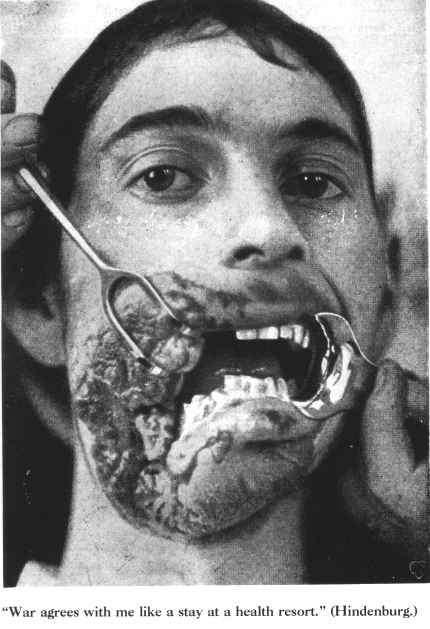 facial reconstruction