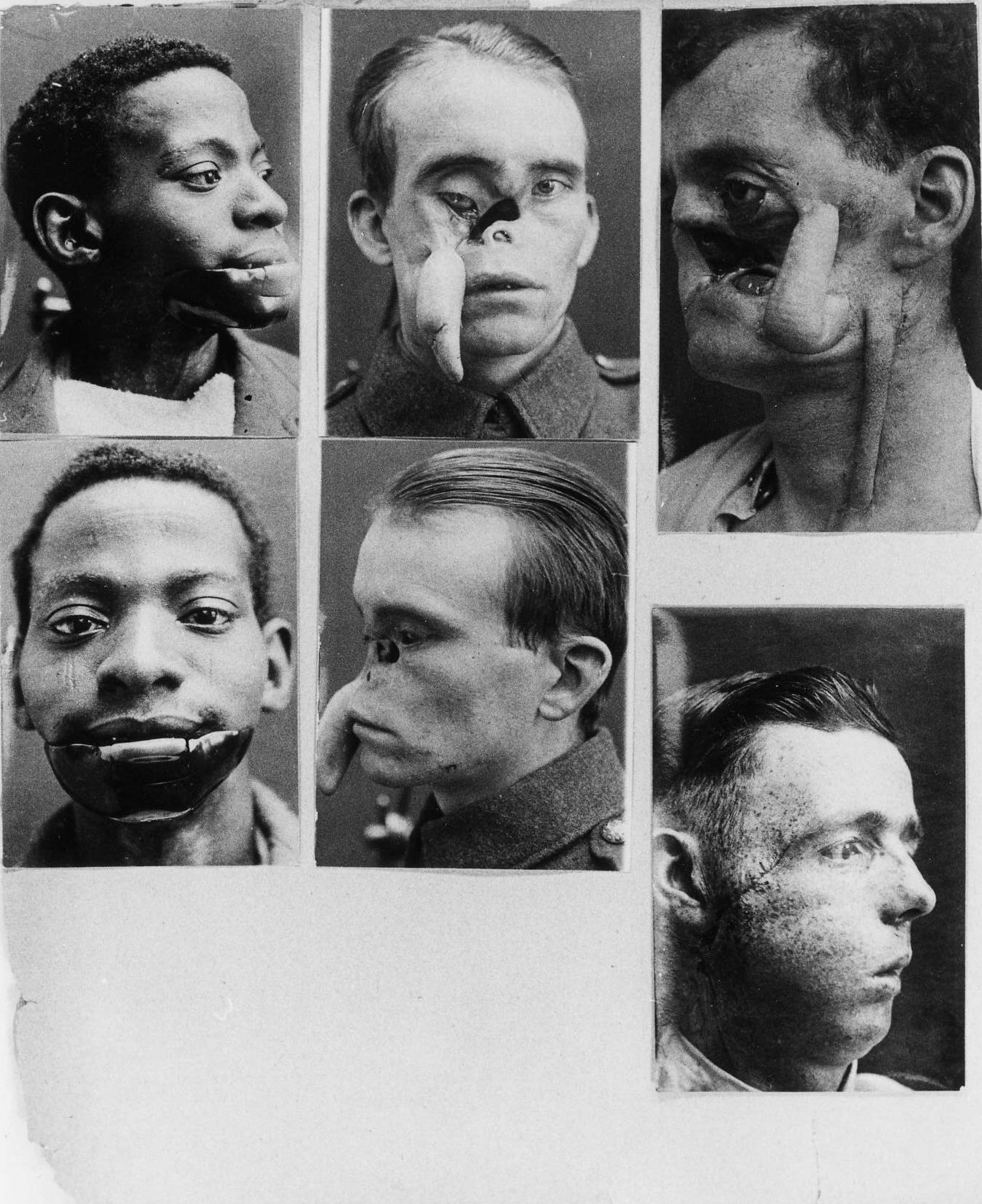 men with broken faces