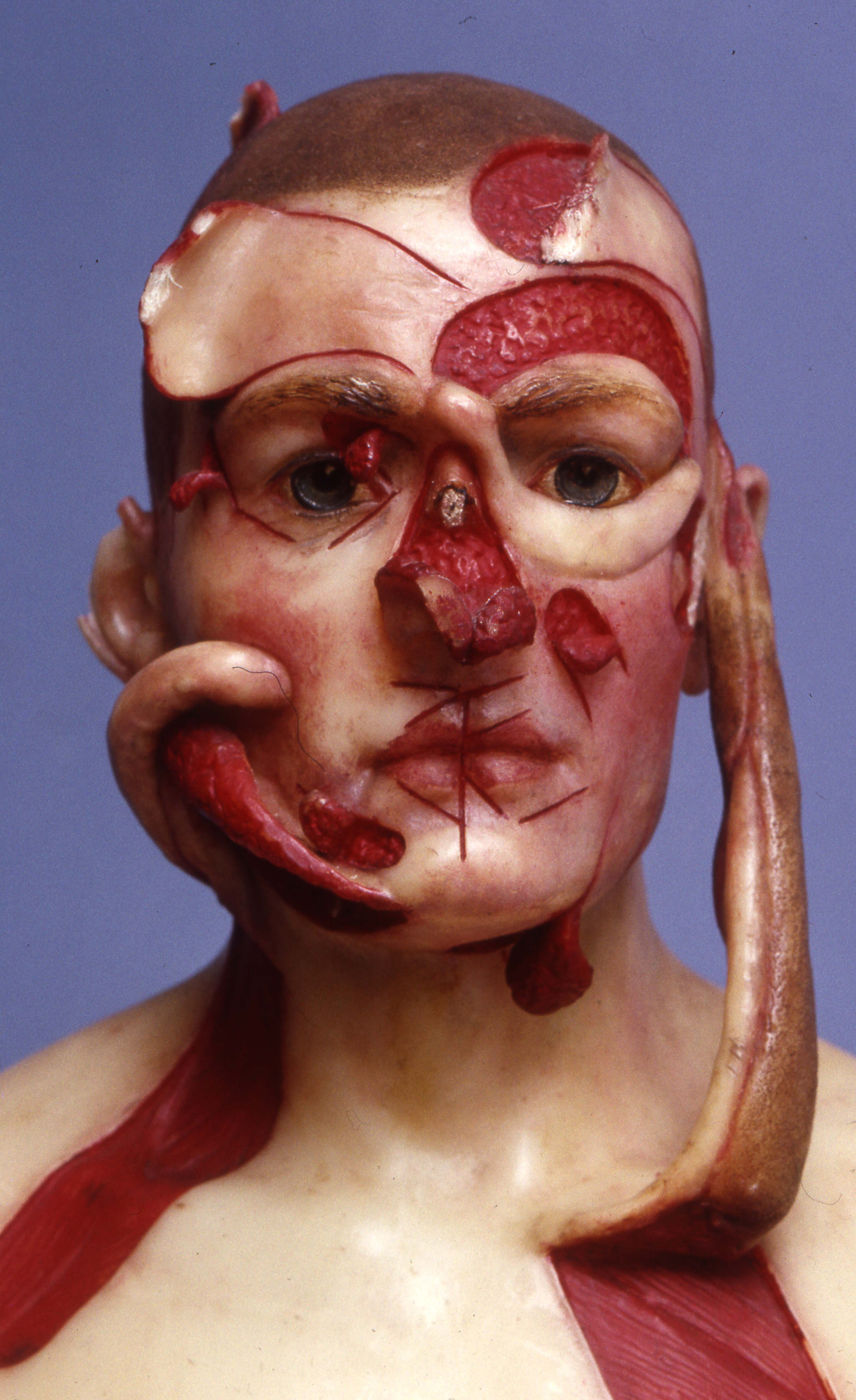 First World War facial reconstruction model
