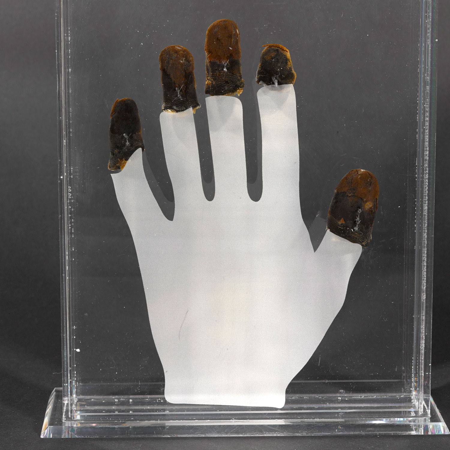 Michael Bronco Lane's frostbitten finger tips on display at the National Army Museum CREDIT National Army Museum copyright