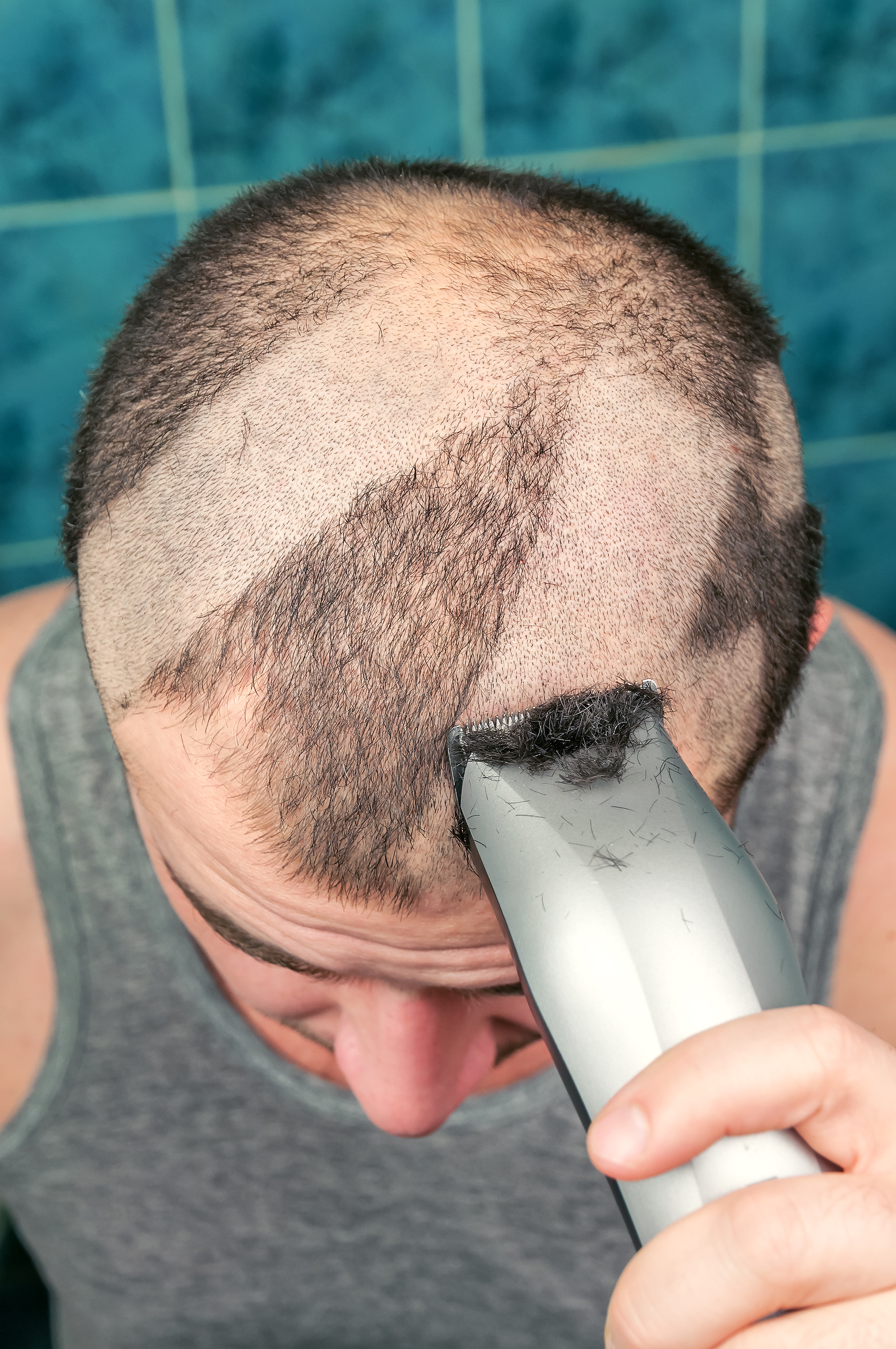 Man Badly Shaving His Head With Clippers Shutterstock Image No Need To Credit