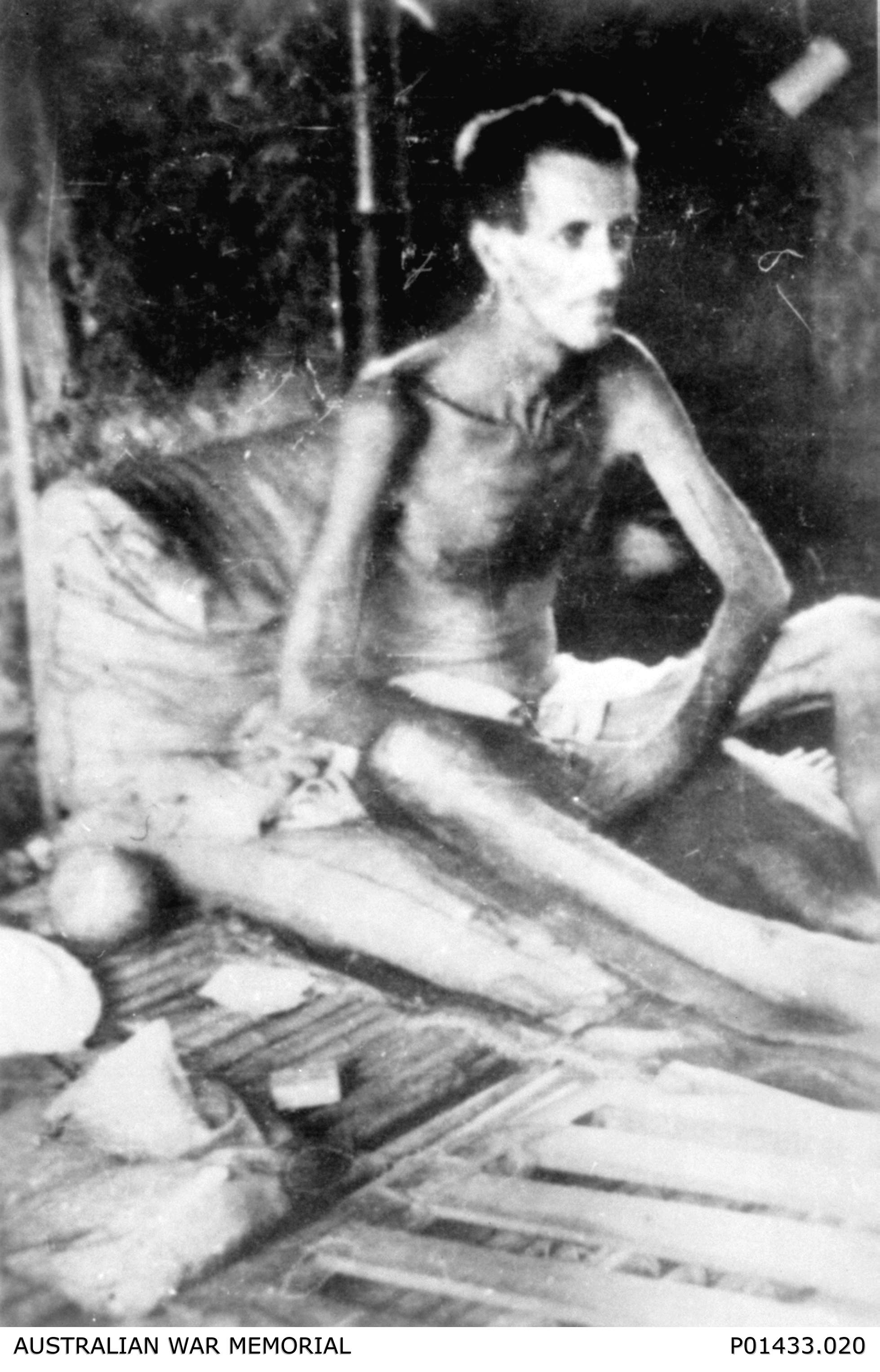 Burma or Thailand. 1945. An emaciated Australian prisoner of war, Corporal Reginald Lloyd Harvey, 2/26 Battalion of Sandgate, Qld. Credit: Australian War Memorial (Donor B. Theobald) - P01433.020