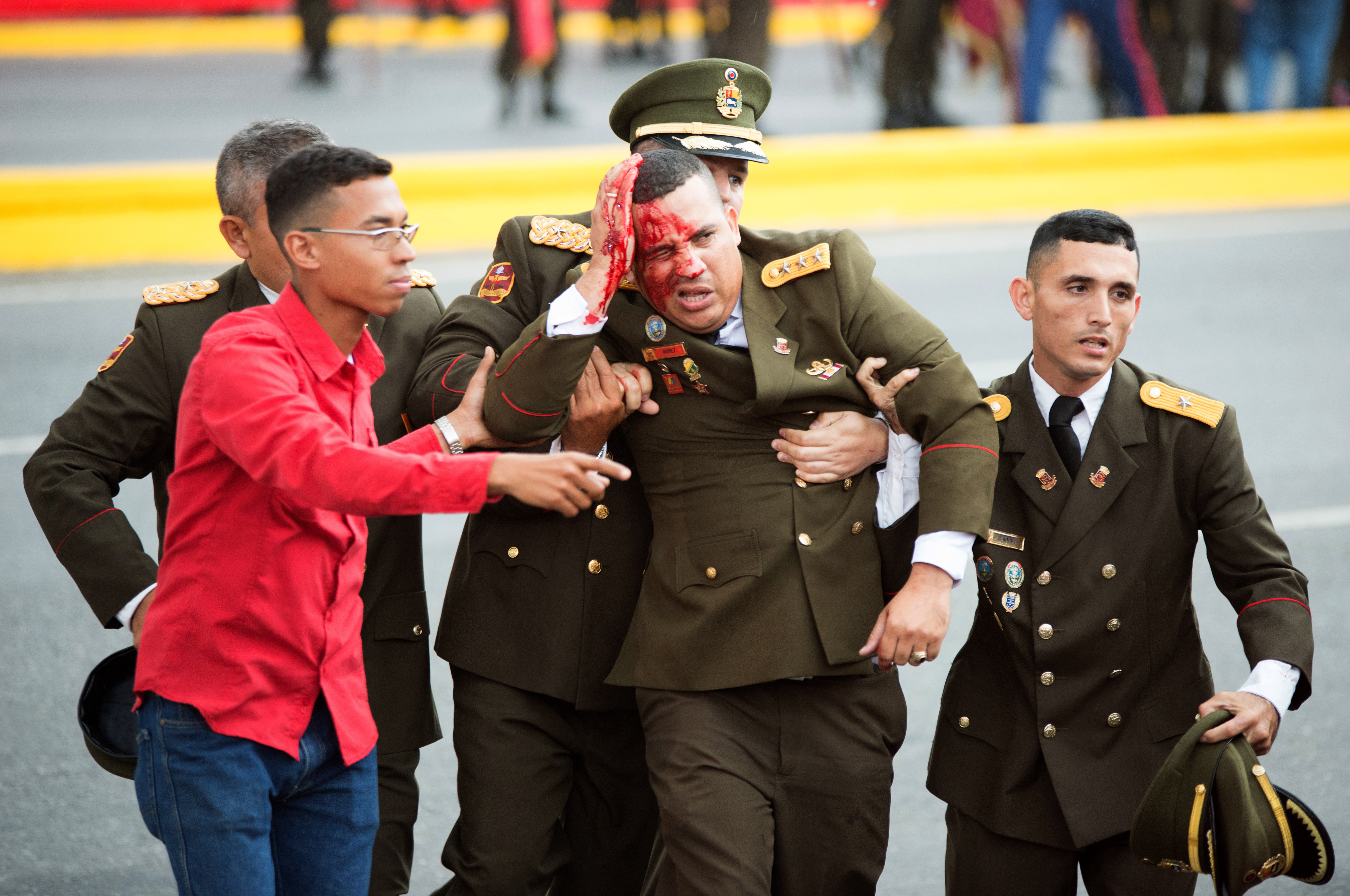 A security member bleeds after Venezuelan President Nicolas Maduro's speech was interrupted (Picture: PA).