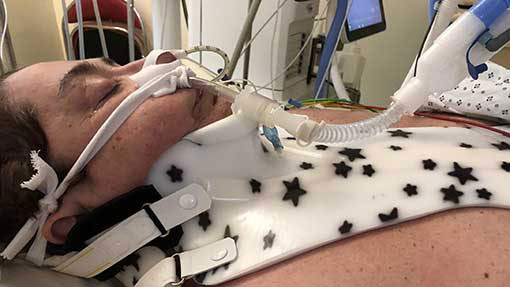 Penny Melville-Brown in a coma after her accident in France CREDIT Penny Melville-Brown