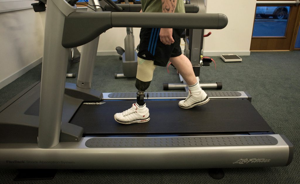 Soldier with a prosthetic leg at the Personnel Recovery Centre in Edinburgh Credit MOD