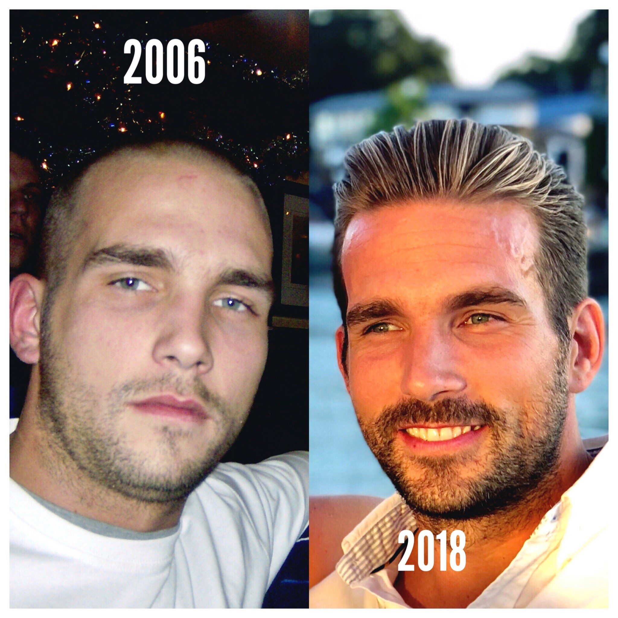 Michael Maisey 12 years difference after getting sober. 