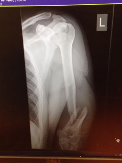 x ray