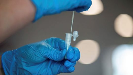 Coronavirus lateral flow test being carried out.
