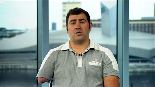 Triple Amputee Speaks About His Medical Care
