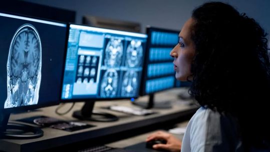 Brain scans mTBI-Predict study concussion US Dept Defense funded 110324 CREDIT University of Birmingham
