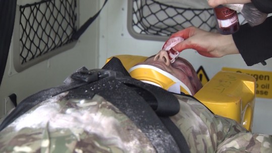 Make-up artist prepares patient for Ex Trenton Serpent