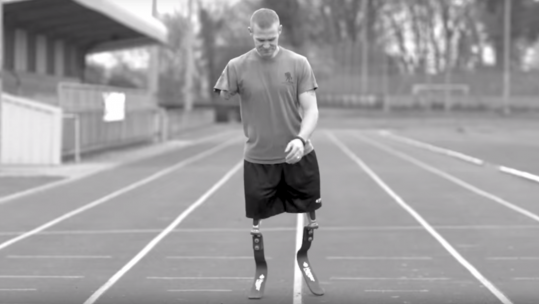 No 'Limbits': Triple Amputee Mark Ormrod Releases Documentary Trailer