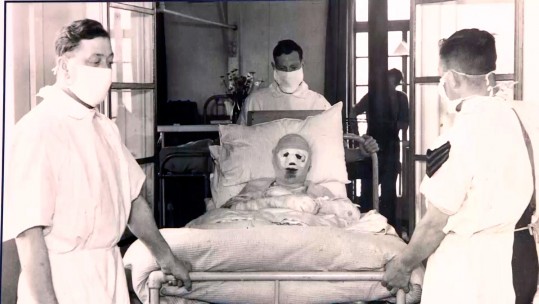 Guinea Pigs Of WW2 Remember Team Who Saved Their Faces