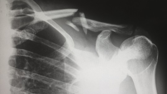 They Say Pain Is Weakness Leaving The Body... 